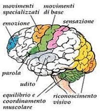 Conosci l'ictus - cos'e' l'ictus cervello Lidia