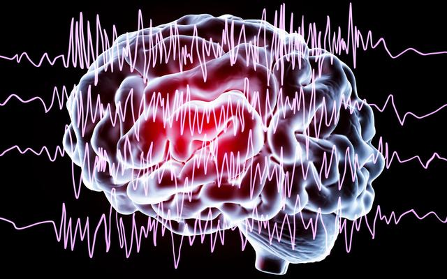 epilessia