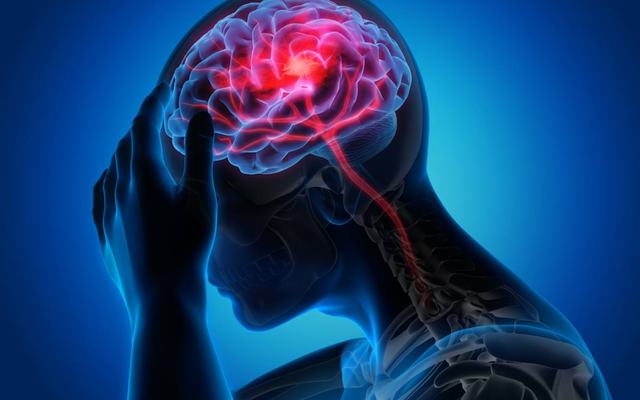 ictus-cerebrale-sintomi.jpg
