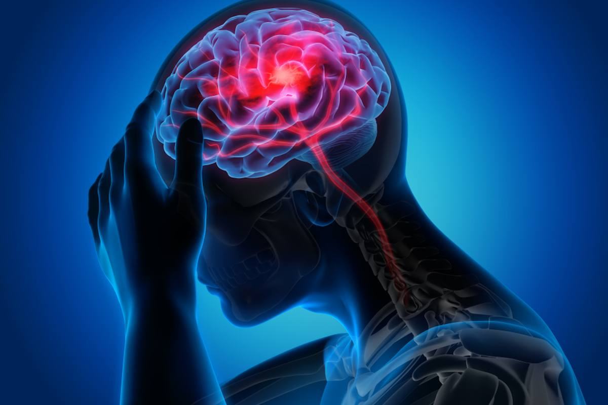 ictus-cerebrale-sintomi.jpg