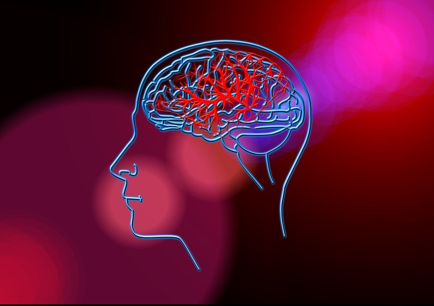 ictus-cerebrale.jpg
