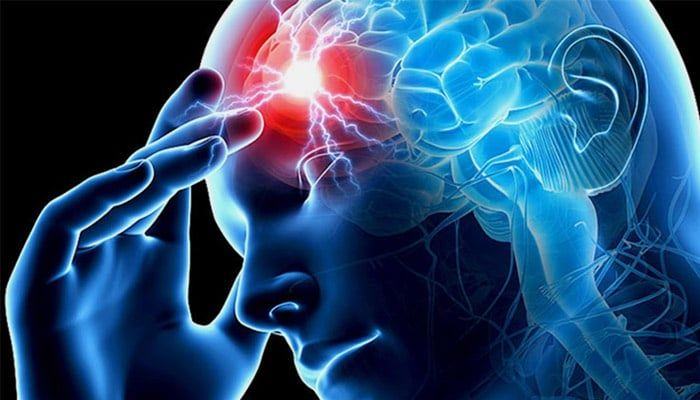 ictus-clinica-elche-neuronova-1