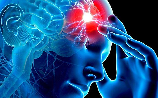 ictus-cerebral.jpg